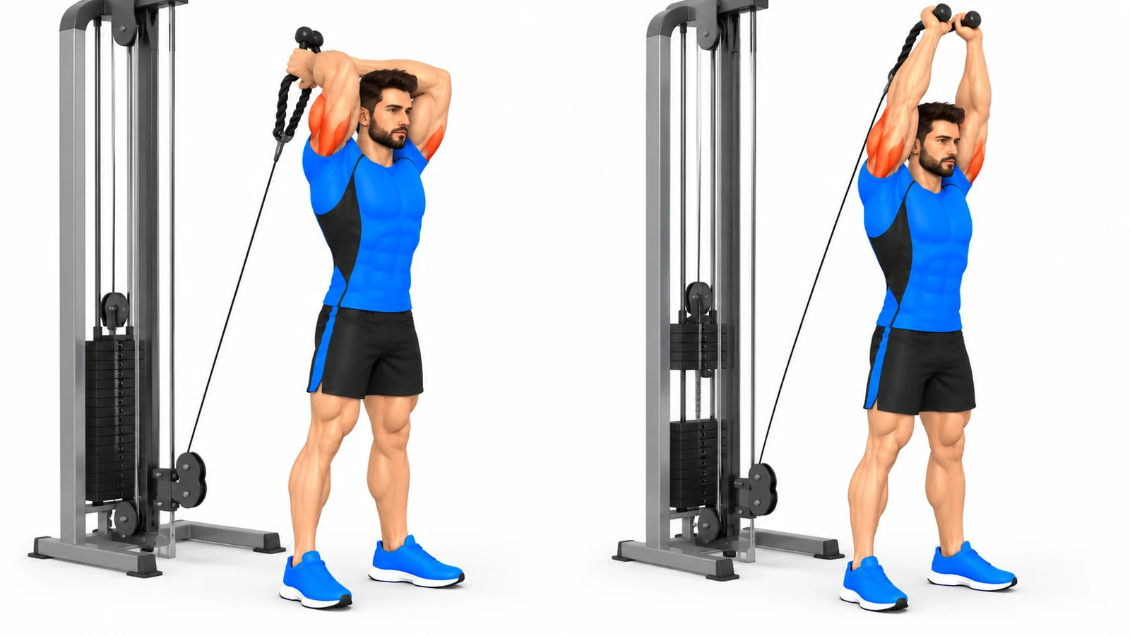 Extension triceps poulie : technique, variantes et programme