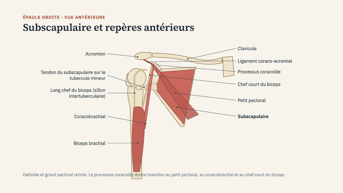 Schéma de l'épaule droite en vue antérieure, deltoïde et grand pectoral retirés : subscapulaire, petit pectoral, coracobrachial, chef court et long chef du biceps, processus coracoïde, acromion et clavicule